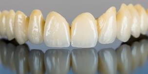 SSAGD: New & Improved Ways in Managing Enamel