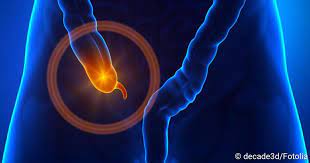 Blinddarmentzundung Symptome Behandlung Ursachen Netdoktor