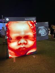 Desirae Young, RDCS, RVT, RDMS