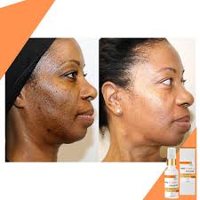 You might be having various questions going on in your mind regarding this product; Amazon Com Vitamin C Collagen Face Creme Serum Reduce Wrinkles Fine Lines Brighten Skin Smooth Skin Fix Hyperpigmentation Made With Premium All Natural Ingredients In The Usa