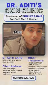 Dr Aditi Garg ( +919988227226 ), MBBS MD Skin & Hair (Gold Medalist), 533  Sita Nagar, Backside Hotel Gulmor, , Near Bus Stand Ludhiana., Timings:,  Morning- 8:30 am to 1:00pm, Evening- 4 pm to 8 pm, ...