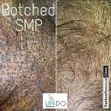 Image result