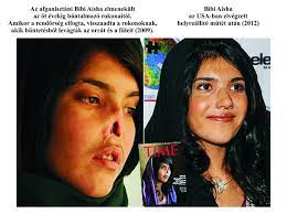 Shabia mantoo, a menekültügyi főbiztosság (unhcr) szóvivője azt mondta: Kuruc Info Afganisztanrol Kendozetlenul Olvasonk Tanulmanya Iii Resz