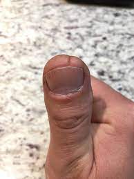I call it my butt thumb. : rmildlyinteresting