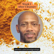 Official Smell Good Spa: Mature Skin Hyperpigmentation Skin Care|  Niacinamide Skin Care