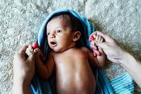 In some cases, it may be delayed if the baby has a medical problem or when an immediate circumcision can. Properly Caring For Your Baby After A Circumcision