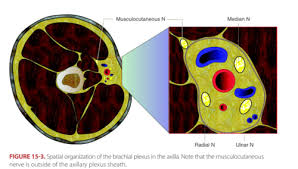 Image result for Axillary Nerve Block