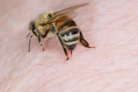 Terapi Sengat Lebah Membawa Segudang Manfaat