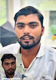 7 days guaranteed results 😱 #aly #alyskincare #foryou