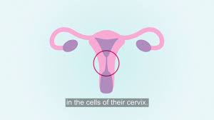 Are there any side effects of my treatment? Hpv Virus 11 Mths You Need To Stop Believing
