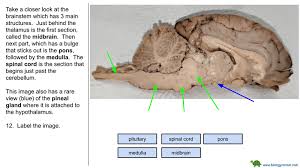 A fissure is a deep groove that separates the major lobes of the brain. Brain Dissect Virtual