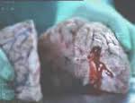 Tobacco Control Videos Every Cigarette Is Doing You Damage