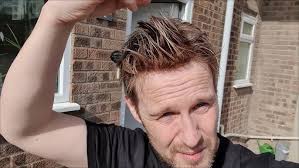 How Effective is a Hair Replacement System for Men in the Sea with Phil  Osmond