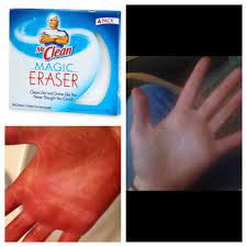 Get Rid Of A Bad Spray Tan On Your Hands By Scrubbing Them With A Mr Clean Magic Eraser It Works Bad Spray Tan Spray Tan Tips Self Tanning Tips