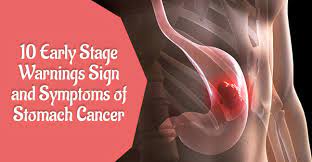 Cancer lumps usually don't hurt. 10 Early Stage Warnings Sign And Symptoms Of Stomach Cancer