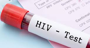 Cuál es situación actual del VIH/SIDA en el mundo? - National ...
