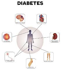 Diabetes Treatment Flow Chart