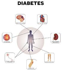 Diabetes Treatment Flow Chart