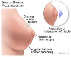 I Found A Lump In My Breast What Should I Do Now Healthworks Malaysia