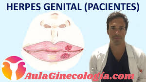 HERPES GENITAL (PACIENTES): Síntomas, tratamiento, embarazo y prevención -  Ginecología y Obstetricia - YouTube