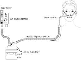 The nasal cannula is a small piece of plastic tubing that is attached to a larger tube which, in turn, connects to the oxygen container. High Flow Nasal Cannula Systemnot Just Another Nasal Cannula Jama Surgery X Mol