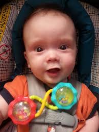 Hip surgery update for Ezio the dog