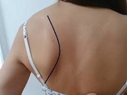 If one of them is sticking out, cover it with a moist, clean cloth and go to an emergency room. Winged Scapula Exercises Posture Direct