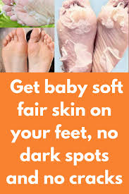 Get baby soft fair skin on your feet, no dark spots and no cracks ...
