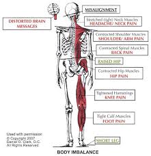 A Common Cause Of Migraine Headaches Boise Idaho Chiropractic Causes Of Migraine Headaches Chiropractic Care