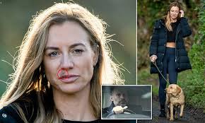 Ryan giggs was arrested on suspicion of assaulting girlfriend kate greville (credits: Pictured Ryan Giggs Ex Girlfriend Kate Greville Is Seen With Bruised Lip As She Walks Dog Daily Mail Online