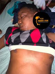 Na the man this way Steady Bongo be go fen way en be Dey return en Kam en  get the Accident 😭😭 the man sef manage all kind way for Kam pay