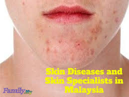 Premier clinic believes that every individual is beautiful. Skin Diseases And Skin Specialists In Malaysia Malaysia Health Family Medicine And Healthcare