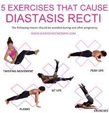 Diastasis recti. julie tupler, rn, certified childbirth. How To Prevent Diastasis Recti From Getting Worse Arxiusarquitectura