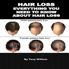 Brylcreem is a brand of hair caring products for men. Amazon Com Hair Loss Everything You Need To Know About Hair Loss Audible Audio Edition Toney William James Bradley Holistic Measures Llc Audible Audiobooks