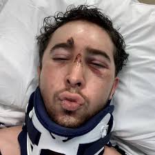 'I was paralysed from neck down but recovered to kick friend in crotch'