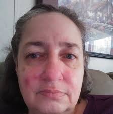 Quick recovery from corona