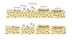 Bone is remodeled thanks to the activity of osteoblasts and osteoclasts, that balance bone resorption and formation. Bone Remodeling Wikiwand