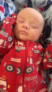 Help with weight gain for down syndrome baby?