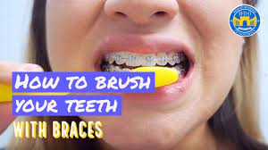 It's a process to brush your teeth with braces. How To Brush With Braces 3 Brushing Tips Youtube