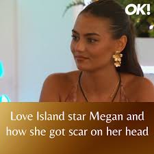 She likes to have fun! 👀  https://www.ok.co.uk/tv/reality/love-island-megan-scar-head-35400675