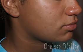 A new nose piercings I have done in the past. My first ever piercing was a  nose piercing, done by my mother and mentor! What was your first piercing?  Got a story