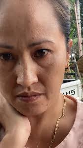 naku ang inyong Marikay nagka chickenpox ,ang sama ng aking pakiramdam,  nagsusuka at sakit ng aking buong katawan #everyoneシ゚ #everyoneactive  #everyone #followers #everyonehighlights #follower  #everyonehighlightsfollowers #reelsviralシ #fbreelsfypシ ...