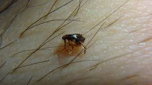 How to stop fleas from biting me. Fleas On Humans Fleas On People Get Rid Of Fleas On Humans