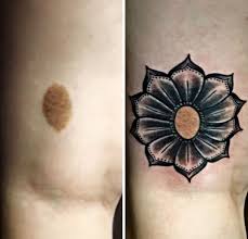 Back Birthmark Cover Up Tattoo Birthmark Flower Tattoo Cover Up Tattoos Birthmark Tattoo Cover Tattoo