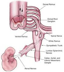 Image result for Nephrolithiasis