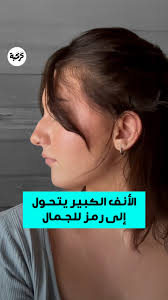 الأنف الكبير أصبح موضة! , الآن يمكنك الاعتزاز بفخر بأنفك الكبير!, #أنف  #تجميل‏, 🎥: Mayakapouranis, Abbieabbieabbie0, Alifnomad, Sammy.braddy