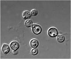 Busse isolated the yeast from the. Photomicrograph Of Cryptococcus Neoformans Strain B3501 Dic 360 Download Scientific Diagram