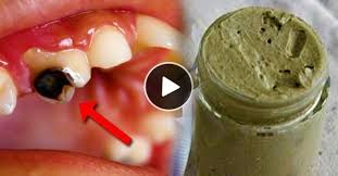 Un Dentifrice Est Un Produit Qui Doit Aider A Nettoyer Vos Dents Des Residus Alimentaires Sans Porter Atteinte A Vos Dent Dental Caries Food Diet And Nutrition