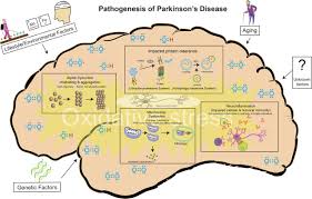 Tremors are common, but the disorder also commonly causes stiffness or slowing of movement. Parkinson S Disease Etiopathogenesis And Treatment Journal Of Neurology Neurosurgery Psychiatry