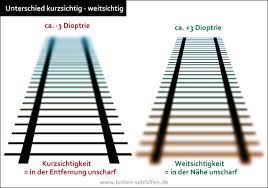 Unterschied Zwischen Kurzsichtig Und Weitsichtig